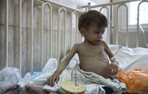 ‘Gaza is witnessing the worst of the worst levels of malnutrition’ ‘Gaza is witnessing the worst of the worst levels of malnutrition’