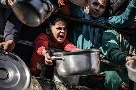 Gaza kids at risk of death from malnutrition Gaza kids at risk of death from malnutrition