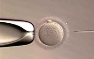 نخستین نوزاد متولد شده با سیستم هوش مصنوعی در IVF دنیا آمد نخستین نوزاد متولد شده با سیستم هوش مصنوعی در IVF دنیا آمد