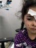 1500 فلسطینی بینایی خود را در جنگ غزه از دست داده اند